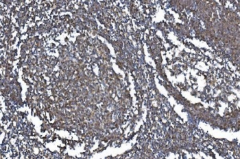 IHC staining of FFPE human tonsil with METTL3 antibody. HIER: boil tissue sections in pH8 EDTA for 20 min and allow to cool before testing.