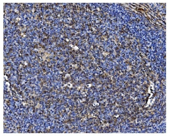 IHC staining of FFPE human tonsil with PCBP1 antibody. HIER: boil tissue sections in pH8 EDTA for 20 min and allow to cool before testing.