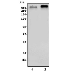 Western blot testing of 1) rat brain and 2) mouse brain lysate with Scn2a antibody. Predicted molecular weight ~320 kDa.