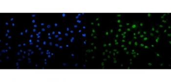 Immunofluorescent staining of FFPE human A549 cells with U2AF2 antibody (green) and DAPI nuclear stain (blue). HIER: steam section in pH6 citrate buffer for 20 min.