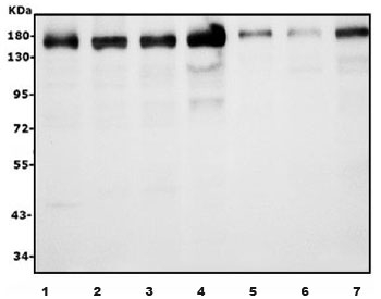 Western blot testing of human 1) HeLa, 2) HepG2, 3) Caco-2, 4) HEK293, 5) MDA-MB-453, 6) PANC-1 and 7) SW620 cell lysate with AFF4 antibody. Predicted molecular weight ~127/98/39 kDa (isoforms 1/2/3).
