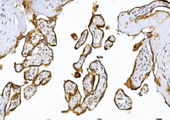 IHC staining of FFPE human placental tissue with ADAMTS5 antibody. HIER: boil tissue sections in pH8 EDTA for 20 min and allow to cool before testing.