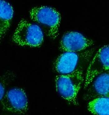 Immunofluorescent staining of FFPE human T-47D cells with MEK5 antibody (green) and DAPI nuclear stain (blue). HIER: steam section in pH6 citrate buffer for 20 min.
