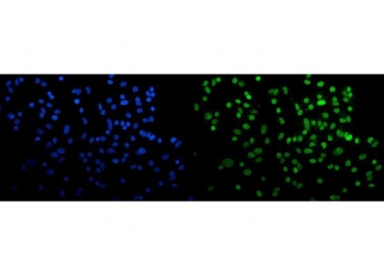 Immunofluorescent staining of FFPE human A549 cells with CBX5 antibody (green) and DAPI nuclear stain (blue). HIER: steam section in pH6 citrate buffer for 20 min.