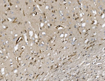 IHC staining of FFPE rat brain with Cd34 antibody. HIER: boil tissue sections in pH8 EDTA for 20 min and allow to cool before testing.