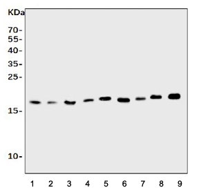 Western blot testing of rat 1) spleen, 2) brain, 3) thymus, 4) kidney and mouse 5) spleen, 6) kidney, 7) RAW264.7 and 8) NIH 3T3 cell lysate with Il1ra antibody. Predicted molecular weight ~20 kDa.