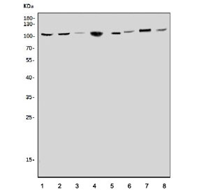 Western blot testing of 1) rat brain, 2) rat liver, 3) rat heart, 4) rat kidney, 5) mouse brain, 6) mouse liver, 7) mouse heart and 8) mouse kidney tissue lysate with CLCN5 antibody. Expected molecular weight: 80-83 kDa (isoform 2) and 90-100 kDa (isoform 1).