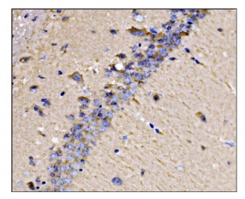 IHC staining of FFPE mouse brain tissue with Dynamin 3 antibody. HIER: boil tissue sections in pH8 EDTA for 20 min and allow to cool before testing.