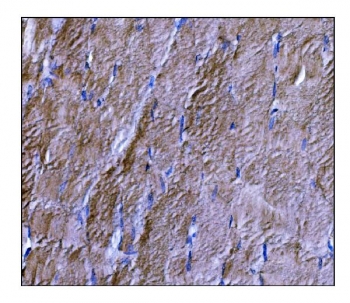 IHC staining of FFPE human skeletal muscle tissue with DYSF antibody. HIER: boil tissue sections in pH8 EDTA for 20 min and allow to cool before testing.