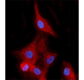 Immunofluorescent staining of FFPE human A549 cells with EHD2 antibody (red) and DAPI nuclear stain (blue). HIER: steam section in pH6 citrate buffer for 20 min.