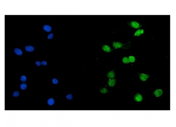 Immunofluorescent staining of FFPE human Caco-2 cells with Histone acetyltransferase 1 antibody (green) and DAPI nuclear stain (blue). HIER: steam section in pH6 citrate buffer for 20 min.