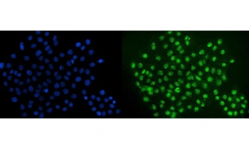 Immunofluorescent staining of FFPE human A431 cells with ERG antibody (green) and DAPI nuclear stain (blue). HIER: steam section in pH6 citrate buffer for 20 min.