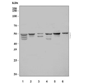 Western blot testing of 1) rat liver, 2) rat kidney, 3) rat RH35, 4) mouse liver, 5) mouse kidney and 6) mouse Neuro-2a cell lysate with SPHK1 antibody. Expected molecular weight: 43-51 kDa (multiple isoforms).