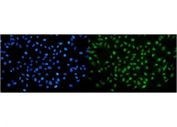 Immunofluorescent staining of FFPE human HeLa cells with NIRF antibody (green) and DAPI nuclear stain (blue). HIER: steam section in pH6 citrate buffer for 20 min.