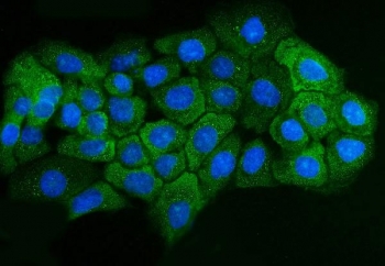 Immunofluorescent staining of FFPE human A431 cells with Adenosine Receptor A2b antibody (green) and DAPI nuclear stain (blue). HIER: steam section in pH6 citrate buffer for 20 min.