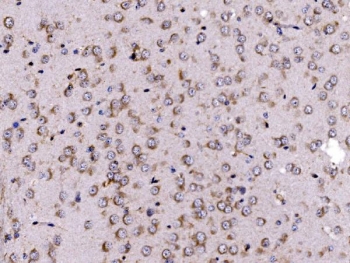 IHC staining of FFPE rat brain tissue with FKBP15 antibody. HIER: boil tissue sections in pH8 EDTA for 20 min and allow to cool before testing.
