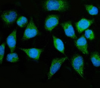 Immunofluorescent staining of FFPE human HeLa cells with MTMR2 antibody (green) and DAPI nuclear stain (blue). HIER: steam section in pH6 citrate buffer for 20 min.