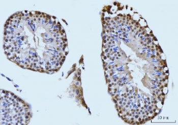 IHC staining of FFPE mouse testis tissue with SBNO1 antibody. HIER: boil tissue sections in pH8 EDTA for 20 min and allow to cool before testing.