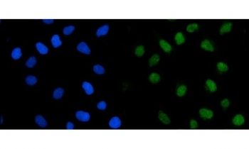 Immunofluorescent staining of FFPE human HeLa cells with TRMT1 antibody (green) and DAPI nuclear stain (blue). HIER: steam section in pH6 citrate buffer for 20 min.