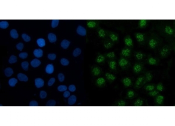 Immunofluorescent staining of FFPE human A431 cells with TMED5 antibody (green) and DAPI nuclear stain (blue). HIER: steam section in pH6 citrate buffer for 20 min.