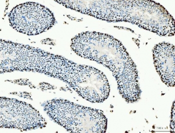 IHC staining of FFPE mouse testis tissue with MCM6 antibody. HIER: boil tissue sections in pH8 EDTA for 20 min and allow to cool before testing.
