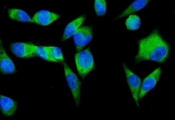 Immunofluorescent staining of FFPE human PC-3 cells with SND1 antibody (green) and DAPI nuclear stain (blue). HIER: steam section in pH6 citrate buffer for 20 min.