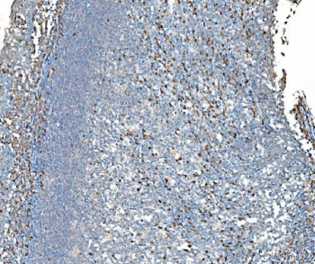 IHC staining of FFPE human tonsil tissue with TDRD11 antibody. HIER: boil tissue sections in pH8 EDTA for 20 min and allow to cool before testing.