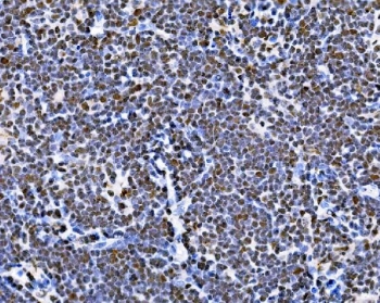 IHC staining of FFPE rat thymus tissue with BUB1 antibody. HIER: boil tissue sections in pH8 EDTA for 20 min and allow to cool before testing.