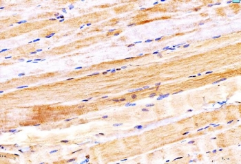 IHC staining of FFPE human heart tissue with Myosin 6 antibody. HIER: boil tissue sections in pH8 EDTA for 20 min and allow to cool before testing.