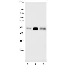Western blot testing of 1) human HeLa, 2) rat brain and 3) mouse brain tissue lysate with ARHB antibody. Predicted molecular weight ~22 kDa.