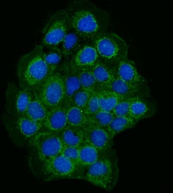 Immunofluorescent staining of FFPE human A431 cells with Zonula occludens protein 2 antibody (green) and DAPI nuclear stain (blue). HIER: steam section in pH6 citrate buffer for 20 min.