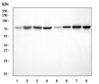 Western blot testing of 1) rat lung, 2) rat liver, 3) rat heart, 4) rat C6, 5) mouse lung, 6) mouse liver, 7) mouse heart and 8) mouse C2C12 cell lysate with ADAM9 antibody. Expected molecular weight: 90-100 kDa (pro-ADAM9-L form) and 70-80 kDa (ADMA9-L form).