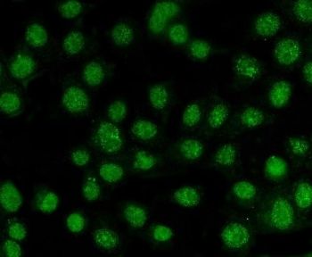 Immunofluorescent staining of FFPE human MCF7 cells with AKT1/2/3 antibody. HIER: steam section in pH6 citrate buffer for 20 min.