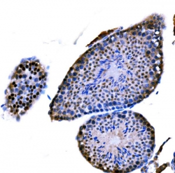 IHC staining of FFPE mouse testis tissue with DMC1 antibody. HIER: boil tissue sections in pH8 EDTA for 20 min and allow to cool before testing.