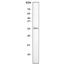 Western blot testing of human U-2 OS cell lysate with FGF11 antibody. Predicted molecular weight ~25 kDa.