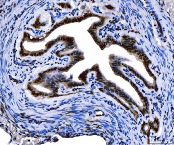 IHC staining of FFPE mouse ovary tissue with FOXL2 antibody. HIER: boil tissue sections in pH8 EDTA for 20 min and allow to cool before testing.
