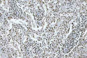 IHC staining of FFPE human spleen tissue with GADD45B antibody. HIER: boil tissue sections in pH8 EDTA for 20 min and allow to cool before testing.