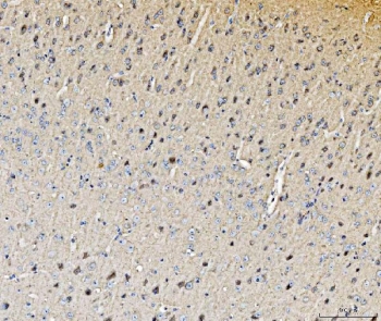 IHC staining of FFPE mouse brain tissue with Histidine decarboxylase antibody. HIER: boil tissue sections in pH8 EDTA for 20 min and allow to cool before testing.