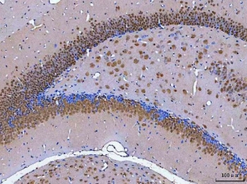 IHC staining of FFPE mouse brain tissue with Rbfox3 antibody. HIER: boil tissue sections in pH8 EDTA for 20 min and allow to cool before testing.