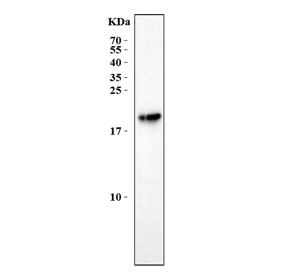 Western blot testing of mouse eye lysate with Aanat antibody. Predicted molecular weight ~23 kDa.