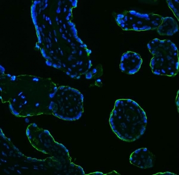 Immunofluorescent staining of FFPE human placental tissue with Placental Alkaline Phosphatase antibody (green) and DAPI nuclear stain (blue). HIER: boil tissue sections in pH8 EDTA for 20 min and allow to cool before testing.