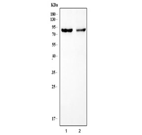 Western blot testing of 1) rat heart and 2) mouse heart tissue lysate with TEM8 antibody. Expected molecular weight: ~83 kDa (PA83) that is cleaved into ~63 kDa (PA63) and ~20 kDa (PA20) fragments.