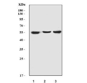 Western blot testing of 1) human HCCP, 2) rat liver and 3) mouse liver lysate with Cytochrome P450 2E1 antibody. Predicted molecular weight ~57 kDa.