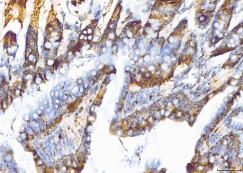 IHC staining of FFPE rat colon tissue with Eukaryotic translation initiation factor 5A-1 antibody. HIER: boil tissue sections in pH8 EDTA for 20 min and allow to cool before testing.