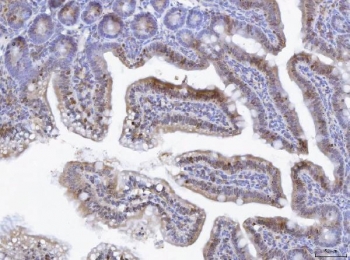 IHC staining of FFPE mouse lymph tissue with TOX antibody. HIER: boil tissue sections in pH8 EDTA for 20 min and allow to cool before testing.