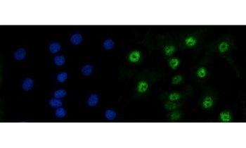 Immunofluorescent staining of FFPE human A549 cells with RAD50 antibody (green) and DAPI nuclear stain (blue). HIER: steam section in pH6 citrate buffer for 20 min.