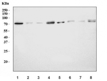 Western blot testing of 1) rat brain, 2) rat stomach, 3) rat small intestine, 4) rat pancreas, 5) mouse brain, 6) mouse stomach, 7) mouse small intestine and 8) mouse pancreas tissue lysate with Ran GTPase-activating protein 1 antibody. Predicted molecular weight 64-70 kDa.