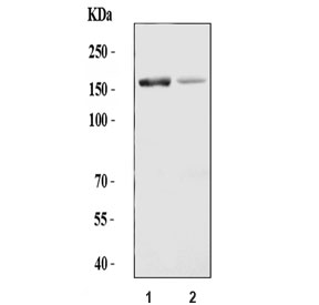 Western blot testing of 1) rat liver and 2) mouse liver tissue lysate with ADAMTS13 antibody. Predicted molecular weight ~154 kDa.