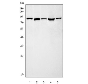 Western blot testing of 1) human HL60, 2) rat brain, 3) rat lung, 4) mouse brain and 5) mouse lung tissue lysate with ADRBK2 antibody. Expected molecular weight ~80 kDa.