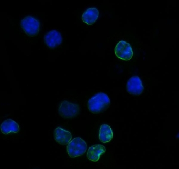 Immunofluorescent staining of FFPE mouse RAW264.7 cells with Il2r alpha antibody (green) and DAPI nuclear stain (blue). HIER: steam section in pH6 citrate buffer for 20 min.